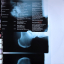 Recoil – Unsound Methods - фото 3 Recoil – Unsound Methods - фото 3